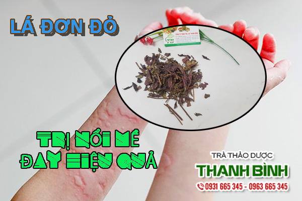 Đặc điểm về lá đơn đỏ