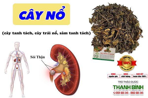 Trị các bệnh về sỏi thận nhờ cây nổ