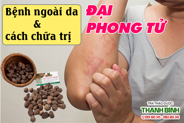 Đại phong tử và công dụng trị các bệnh ngoài da hiệu quả
