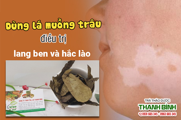 Bài thuốc chữa lang beng, hắc lào bằng lá muồng trâu