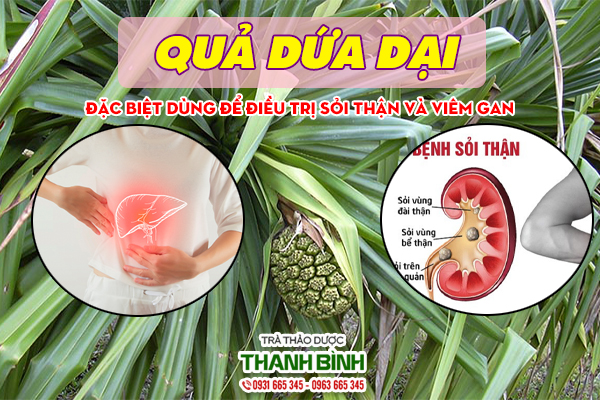 Dứa dại và một số bài thuốc trị bệnh hiệu quả