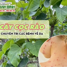 Mua bán cây cọc rào ở huyện Củ Chi hỗ trợ trị các vết thương bị bầm tím an toàn hiệu quả nhất